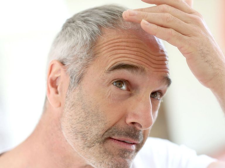 Mann begutachtet sein lichter werdendes Haar