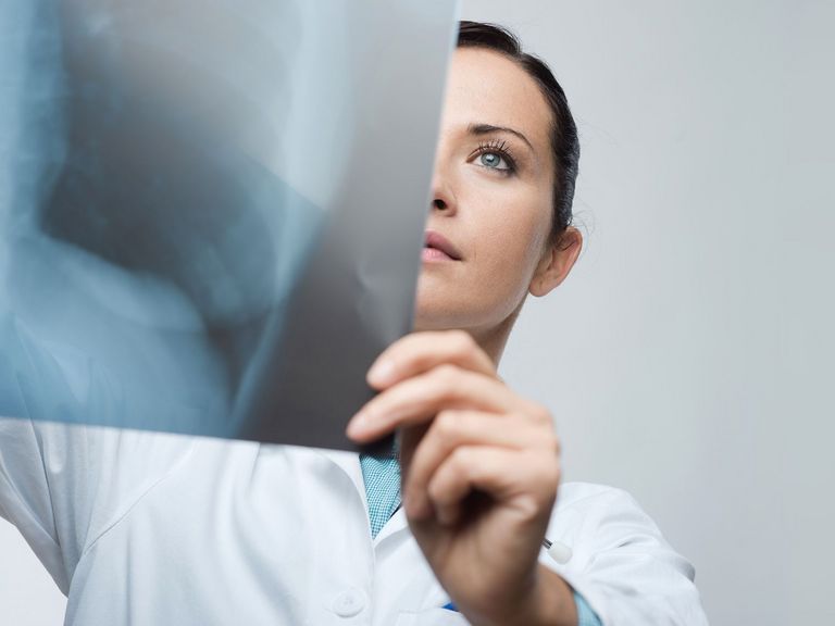 Frau untersucht Röntgenaufnahme vom Brustkorb