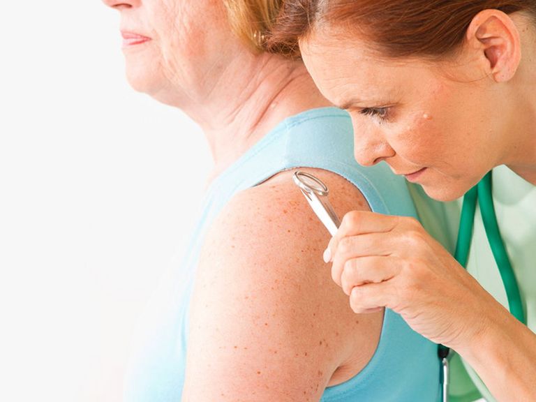 Ärztin untersucht die Haut einer Patientin