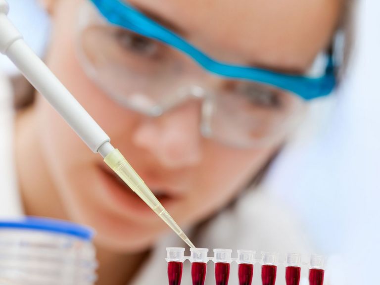 Labormitarbeiterin bereitet einen Test vor