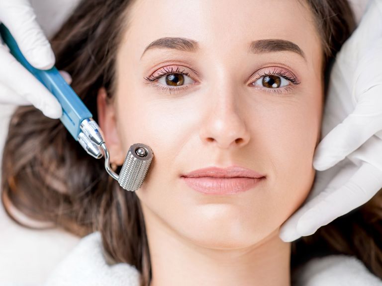 Microneedling Behandlung im Gesicht einer Frau im Kosmetikstudio