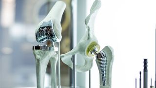 Modell mitImplantaten für Hüfte und Knie