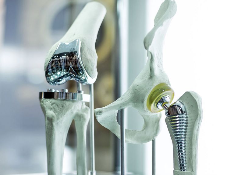 Modell mitImplantaten für Hüfte und Knie