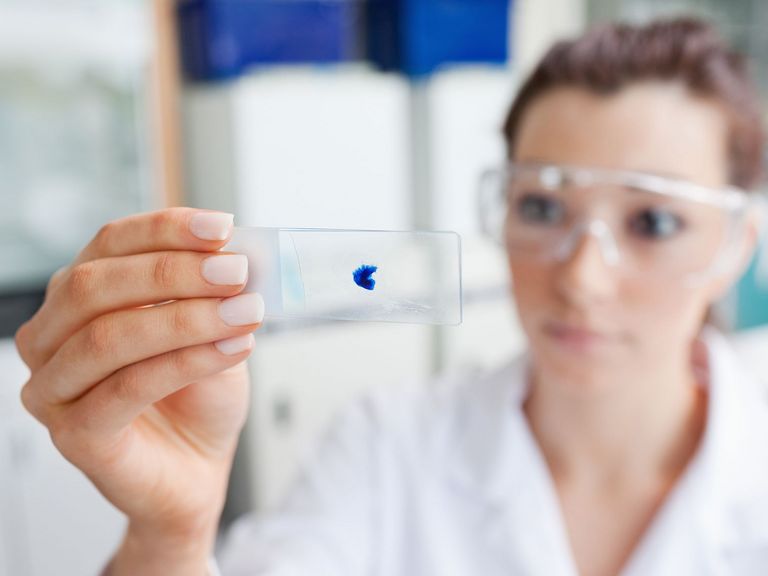 Labormitarbeiterin kontrolliert Test auf einem Objektträger