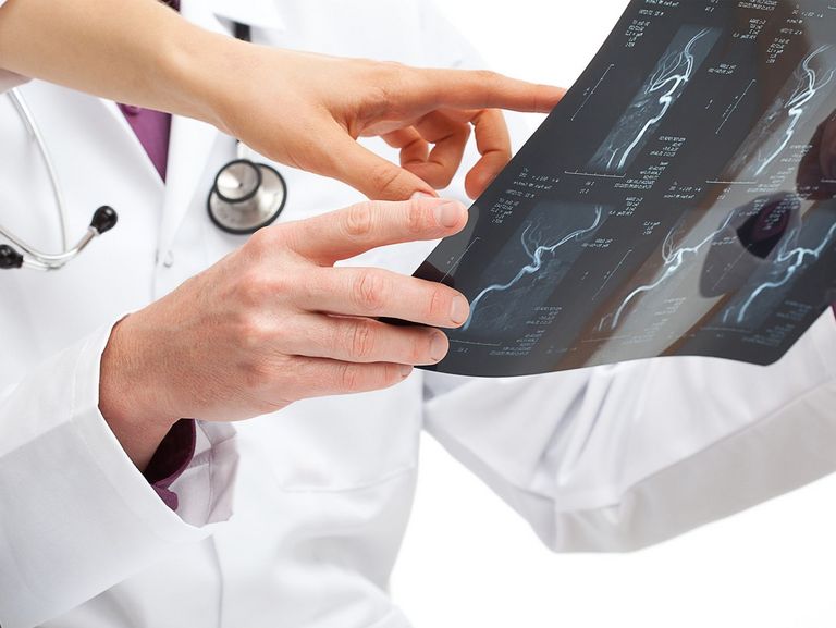 Ärzte betrachten ein Röntgenbild