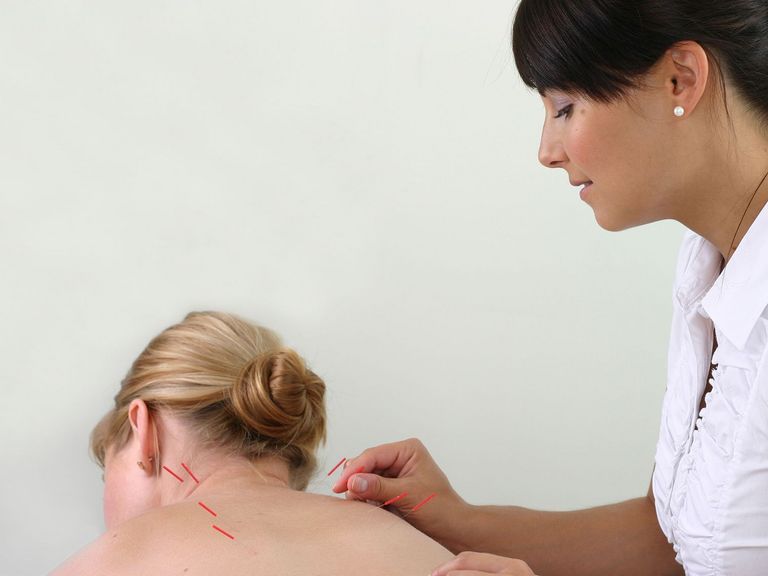 Ärztin führt Akupunktur an Patientin durch